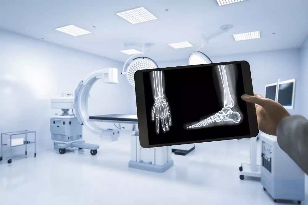 Digital X-Rays